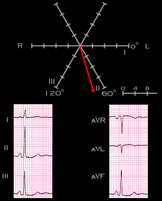 2.3.20 | Understanding the Electrocardiogram